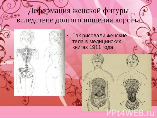 Так рисовали женские тела в медицинских книгах 1911 года