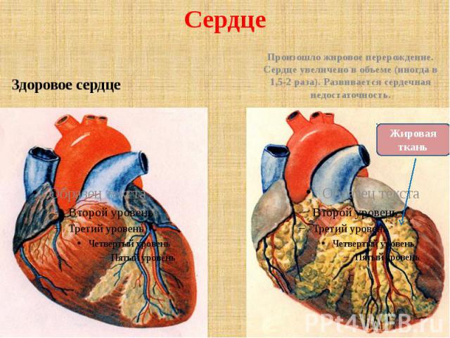 Сердце Здоровое сердце