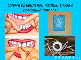 Схема правильной чистки зубов с помощью флосса: