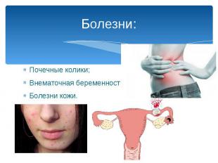 Болезни: Почечные колики; Внематочная беременность; Болезни кожи.