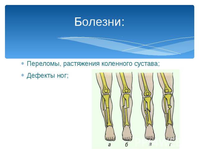 Болезни: Переломы, растяжения коленного сустава; Дефекты ног;