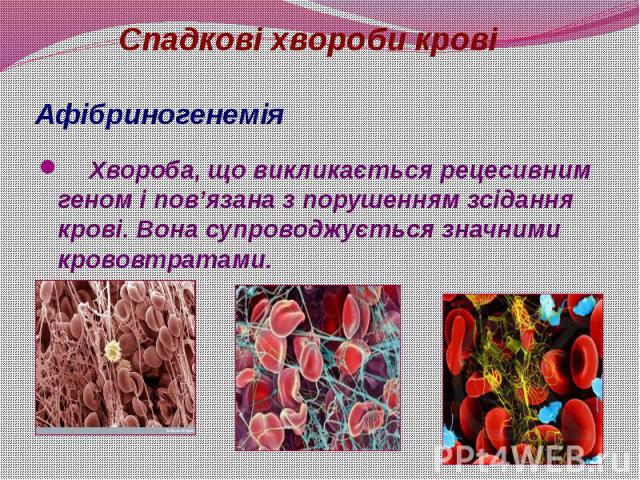 Афібриногенемія Хвороба, що викликається рецесивним геном і пов’язана з порушенням зсідання крові. Вона супроводжується значними крововтратами.