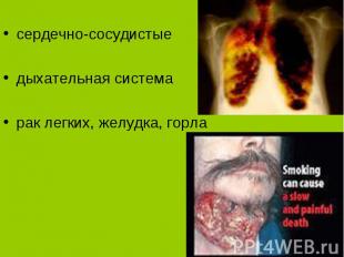 сердечно-сосудистые дыхательная система рак легких, желудка, горла