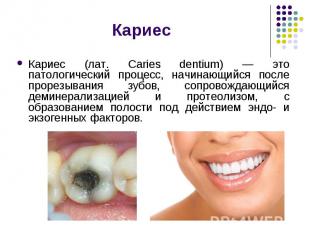 Кариес (лат. Caries dentium) — это патологический процесс, начинающийся после пр
