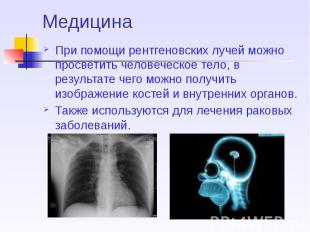 Медицина При помощи рентгеновских лучей можно просветить человеческое тело, в ре
