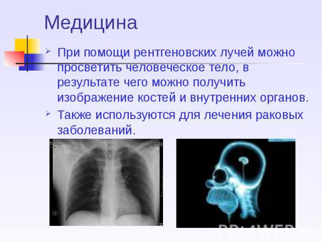 Медицина При помощи рентгеновских лучей можно просветить человеческое тело, в результате чего можно получить изображение костей и внутренних органов. Также используются для лечения раковых заболеваний.