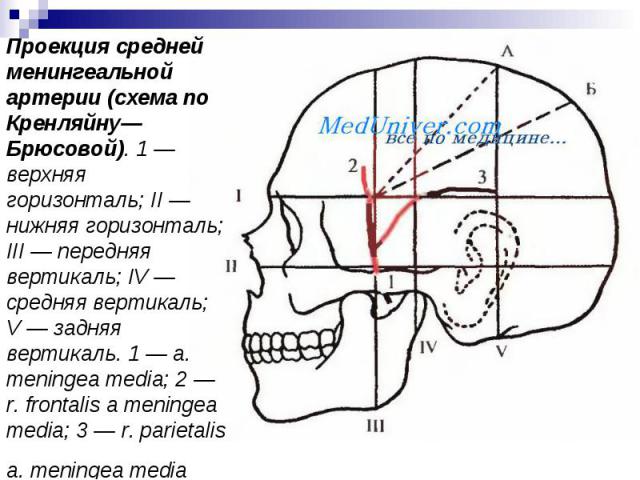 Проекция средней менингеальной артерии (схема по Кренляйну—Брюсовой). 1 — верхняя горизонталь; II — нижняя горизонталь; III — передняя вертикаль; IV — средняя вертикаль; V — задняя вертикаль. 1 — a. meningea media; 2 — r. frontalis a meningea media;…