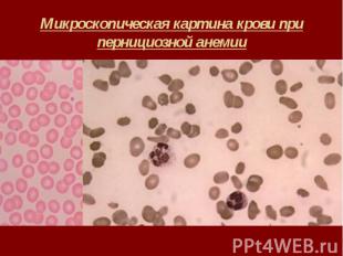Микроскопическая картина крови при пернициозной анемии