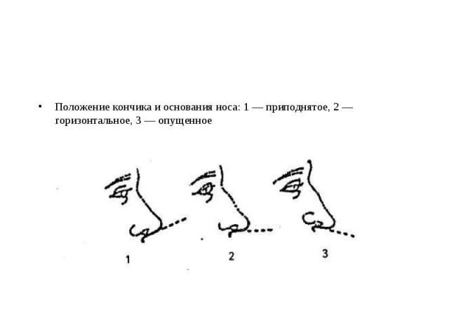 Положение кончика и основания носа: 1 — приподнятое, 2 — горизонтальное, 3 — опущенное Положение кончика и основания носа: 1 — приподнятое, 2 — горизонтальное, 3 — опущенное