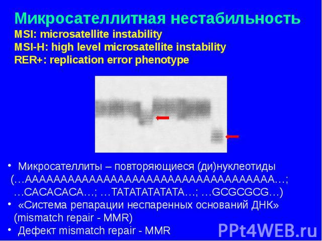 Микросателлитная нестабильность MSI: microsatellite instability MSI-H: high level microsatellite instability RER+: replication error phenotype