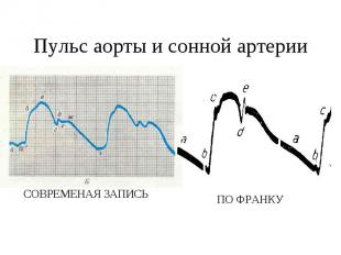 Пульс аорты и сонной артерии