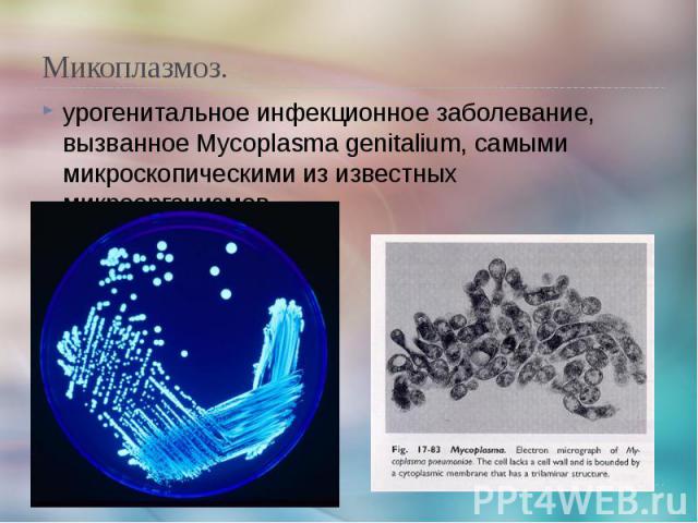 Микоплазмоз. урогенитальное инфекционное заболевание, вызванное Mycoplasma genitalium, самыми микроскопическими из известных микроорганизмов.