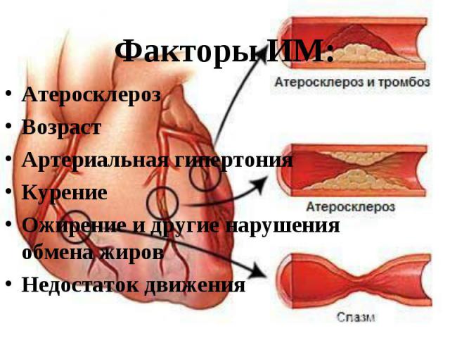 Атеросклероз Атеросклероз Возраст Артериальная гипертония Курение Ожирение и другие нарушения обмена жиров Недостаток движения