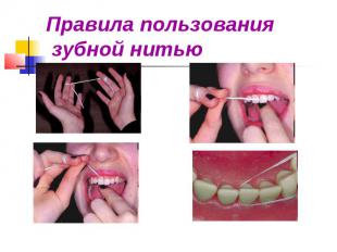 Правила пользования зубной нитью