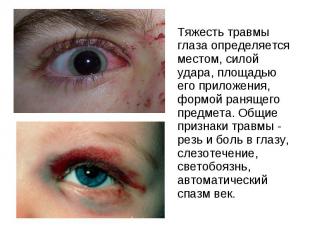 Тяжесть травмы глаза определяется местом, силой удара, площадью его приложения,