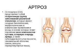 Остеоартроз (ОА) представляет собой гетерогенную группу заболеваний различной эт