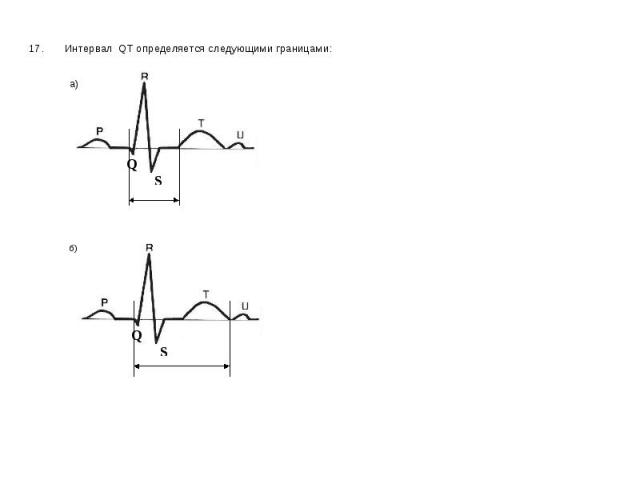 17. Интервал QT определяется следующими границами: 17. Интервал QT определяется следующими границами: