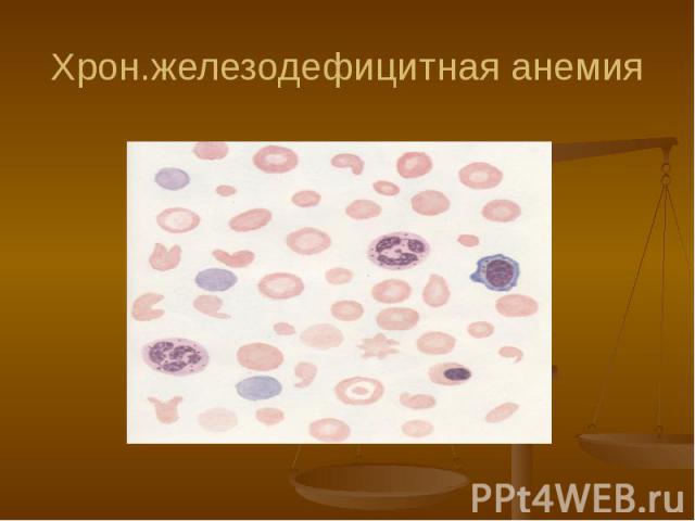 Хрон.железодефицитная анемия