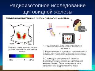 Радиоизотопное исследование щитовидной железы