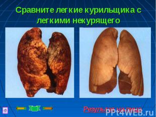 Сравните легкие курильщика с легкими некурящего Результат на лицо