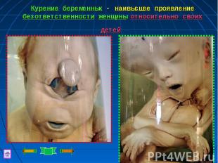 Курение беременных - наивысшее проявление безответственности женщины относительн