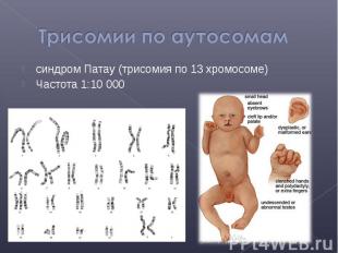 синдром Патау (трисомия по 13 хромосоме) синдром Патау (трисомия по 13 хромосоме