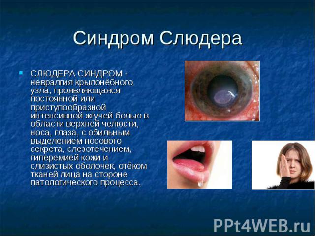 Синдром Слюдера СЛЮДЕРА СИНДРОМ - невралгия крылонёбного узла, проявляющаяся постоянной или приступообразной интенсивной жгучей болью в области верхней челюсти, носа, глаза, с обильным выделением носового секрета, слезотечением, гиперемией кожи и сл…