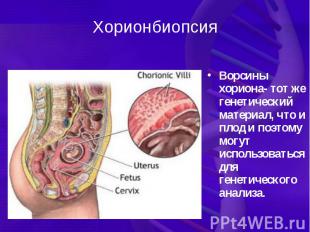 Хорионбиопсия Ворсины хориона- тот же генетический материал, что и плод и поэтом