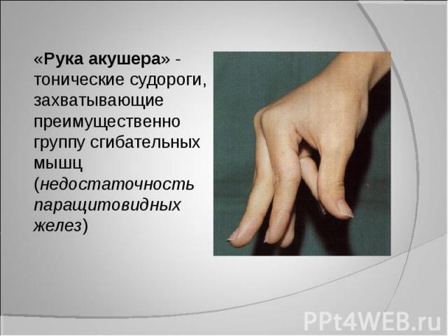 «Рука акушера» - тонические судороги, захватывающие преимущественно группу сгибательных мышц (недостаточность паращитовидных желез) «Рука акушера» - тонические судороги, захватывающие преимущественно группу сгибательных мышц (недостаточность паращит…
