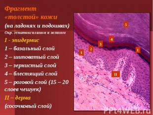 Фрагмент «толстой» кожи (на ладонях и подошвах) Окр. гематоксилином и эозином I
