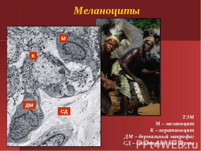 Меланоциты ТЭМ М – меланоцит К – кератиноцит ДМ – дермальный макрофаг СД – сосочковый слой дермы