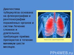 Диагностика туберкулёза основана на флюорографии и рентгенографии поражённых орг