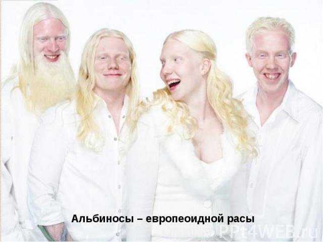 Альбиносы – европеоидной расы