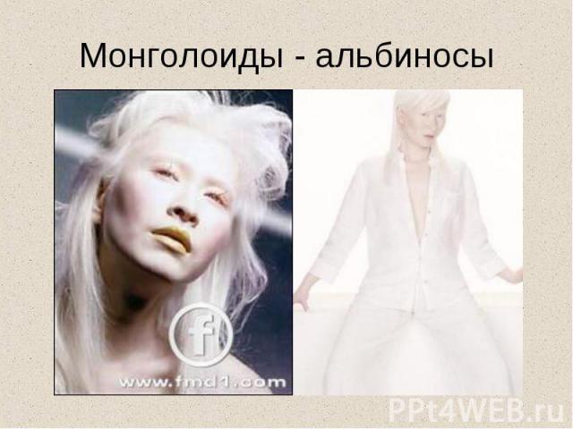 Монголоиды - альбиносы