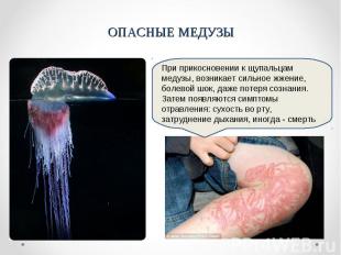 ОПАСНЫЕ МЕДУЗЫПри прикосновении к щупальцам медузы, возникает сильное жжение, бо