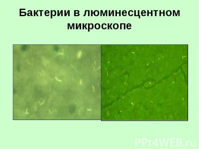 Бактерии в люминесцентном микроскопе