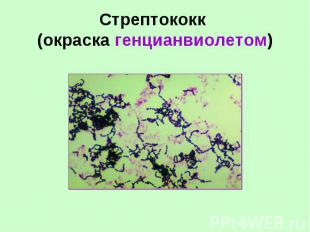 Стрептококк (окраска генцианвиолетом)