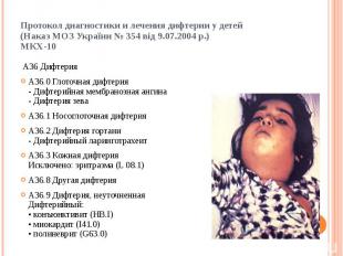 Протокол диагностики и лечения дифтерии у детей (Наказ МОЗ України № 354 від 9.0