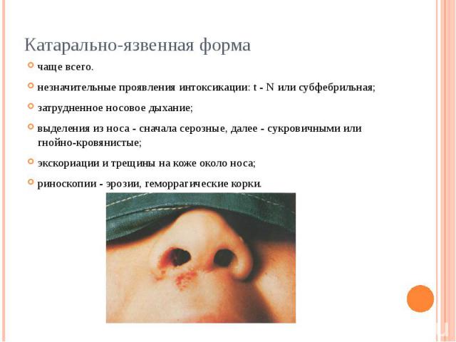 Катарально-язвенная форма чаще всего. незначительные проявления интоксикации: t - N или субфебрильная; затрудненное носовое дыхание; выделения из носа - сначала серозные, далее - сукровичными или гнойно-кровянистые; экскориации и трещины на коже око…